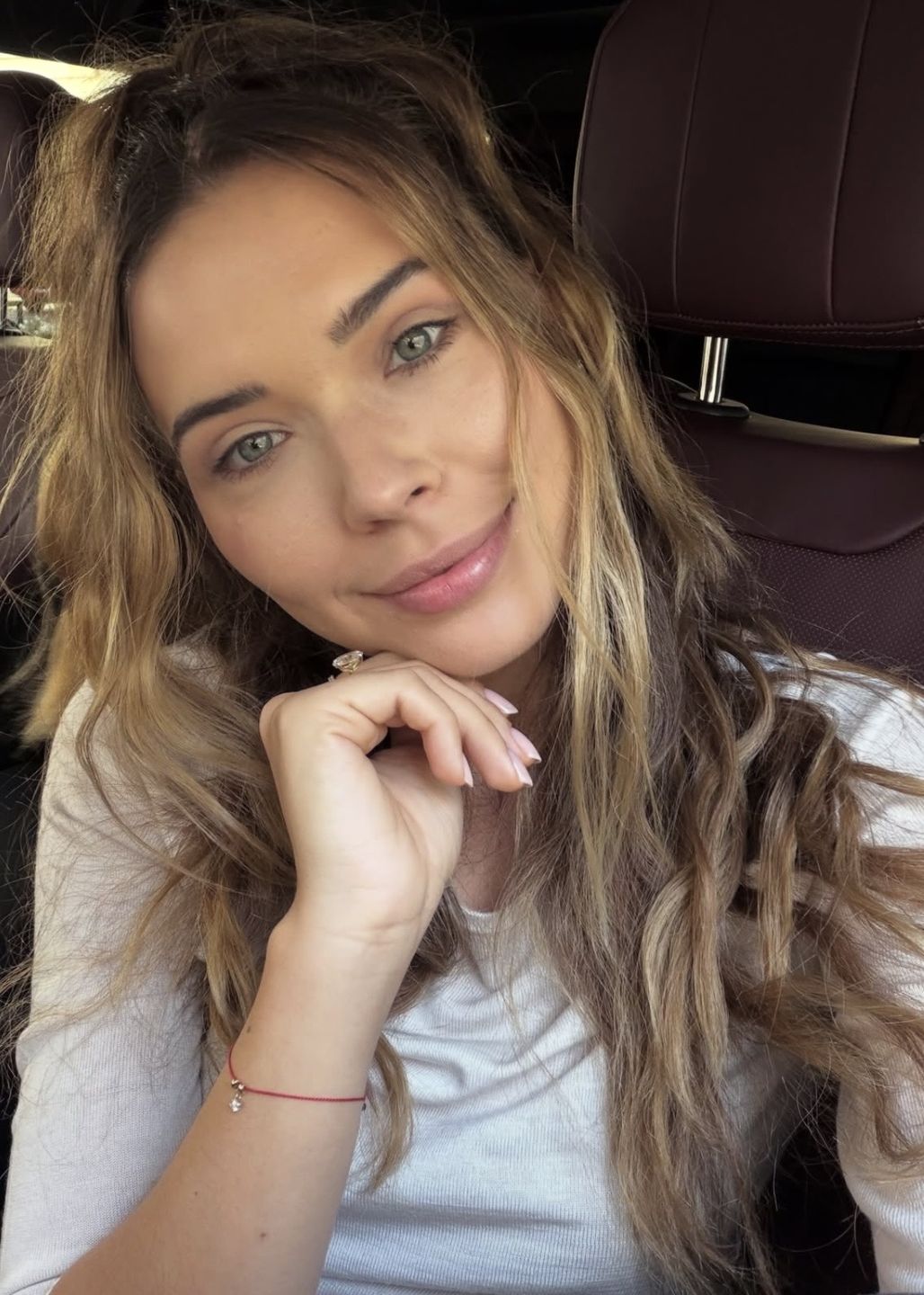 Sandra Kubicka pokazała się 20 dni po operacji 