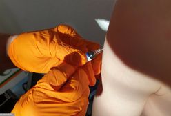Wielka Brytania: Wykryto nowy wariant wirusa "małpiej ospy". Specjaliści nawołują do szczepień