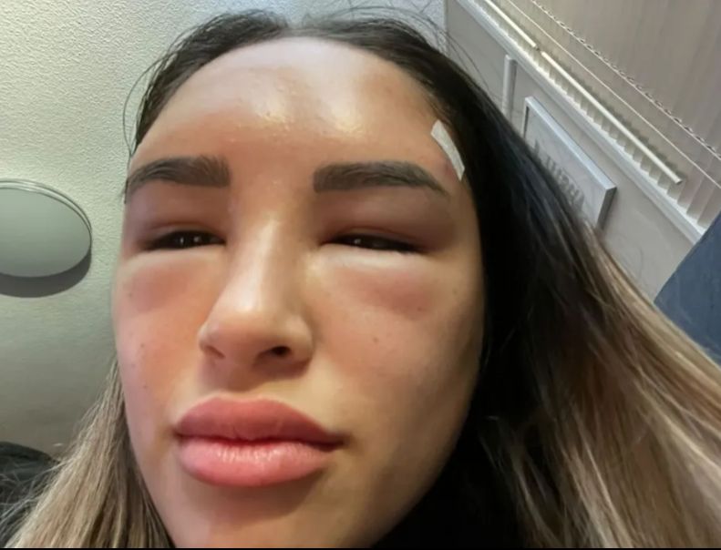 Takiego efektu młoda kobieta na pewno się nie spodziewała