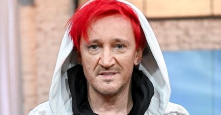 Internauci zaniepokojeni wyglądem Michała Wiśniewskiego. Muzyk wyjaśnił, co się stało (FOTO)