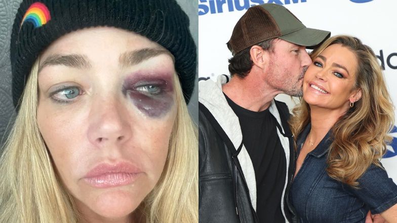 Denise Richards oskarża męża o przemoc