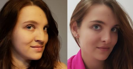 Magdalena Grochocka urodziła się z rozszczepem wargi i podniebienia. Jednym postem wywołała ważną dyskusję