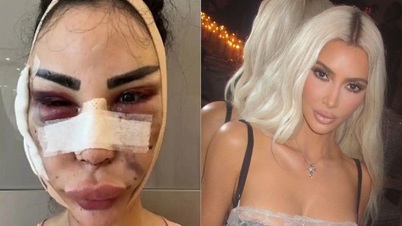 Wydała 3 miliony, aby upodobnić się do Kim Kardashian