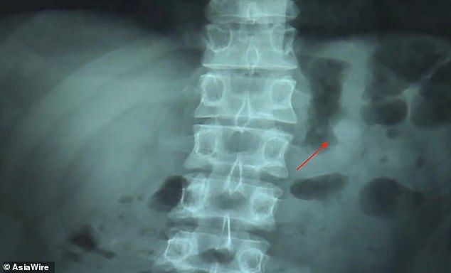 RTG Bena Hsu / Fot. Asia Wire