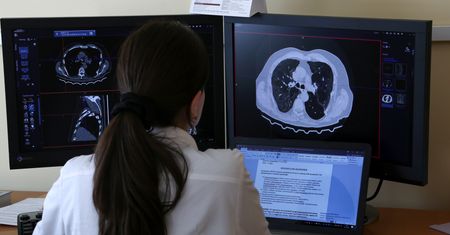 COVID-19. Wyhodowali płuca i zarazili je koronawirusem. Co się stało?