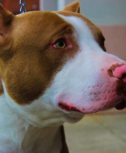 Przemyśl. Pitbulle zagryzły 12-latka. Dramatyczny apel właścicielki psów