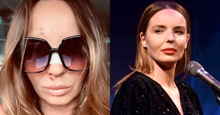Agnieszka Włodarczyk przytacza rozmowę z lekarzem i tajemniczo apeluje: "Organizm daje nam sygnały, NIE LEKCEWAŻCIE ZDROWIA"