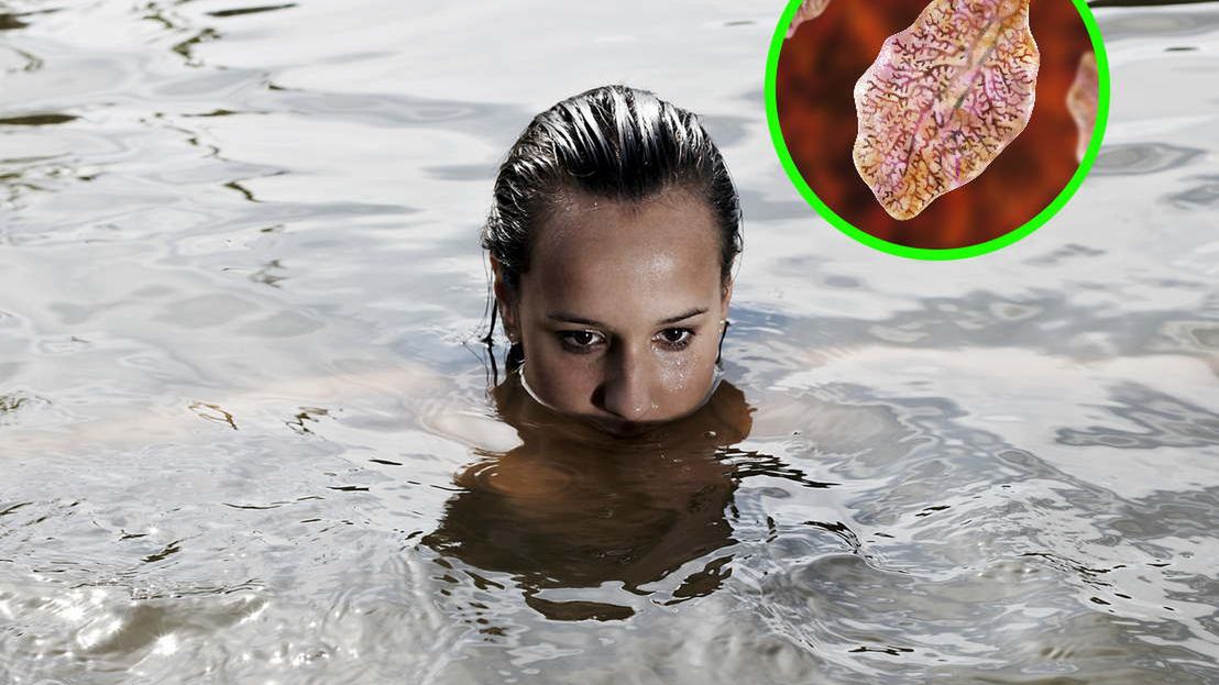 Groźne pasożyty, które kochają wodę. Przebijają się przez ścianę jelita i wwiercają w wątrobę