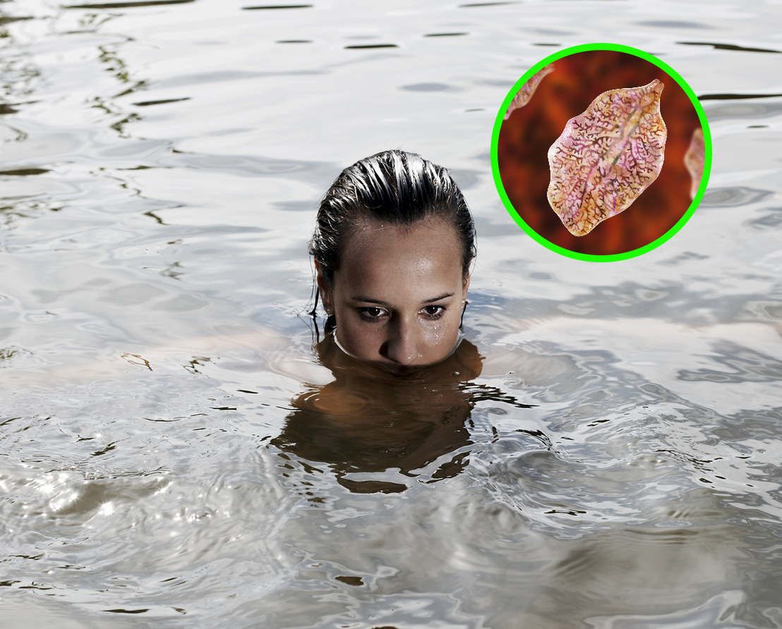 Groźne pasożyty, które kochają wodę. Przebijają się przez ścianę jelita i wwiercają w wątrobę