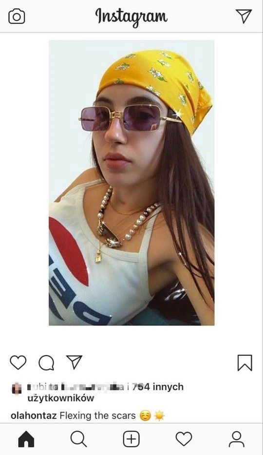 Ola Kowalska pokazuje bliznę na Instagramie