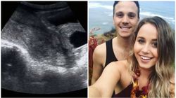 Poroniła w 8 tygodniu. Swoją historią podzieliła się w sieci i zjednoczyła wiele kobiet