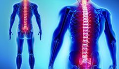 Implanty mają leczyć urazy i schorzenia kręgosłupa. Do sprzedaży trafią w ciągu kilku lat