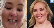 Mama June twierdziła, że wydała 150 TYSIĘCY ZŁOTYCH na licówki. Pokazała, jak po latach wyglądają jej zęby (FOTO)