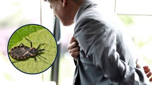 "Całujący robak" groźniejszy niż malaria. Jego ugryzienie może prowadzić do zawału i nagłej śmierci