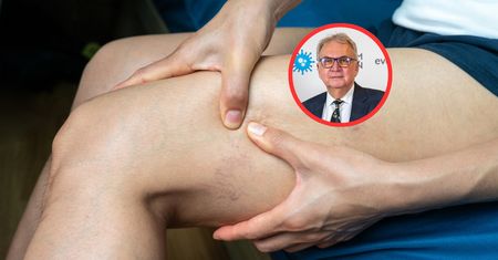 Przyczyna zakrzepicy. Ekspert mówi, co "zapobiega zaleganiu krwi"
