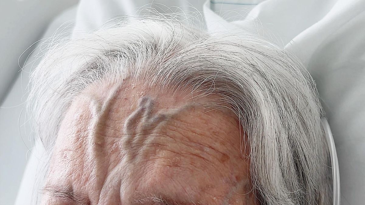 Niespotykany objaw na czole 89-latki