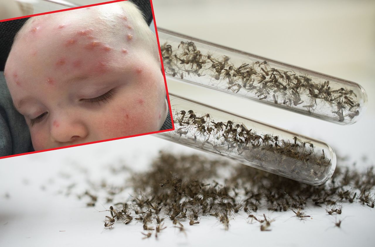 Dla dzieci ukąszenia komarów mogą być groźne. Tych objawów nie bagatelizuj
