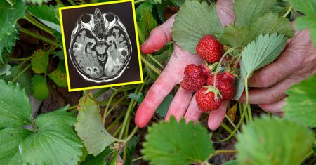 Lekarz pokazał zdjęcie mózgu. Ostrzega przed chorobą "niemytych jagód"
