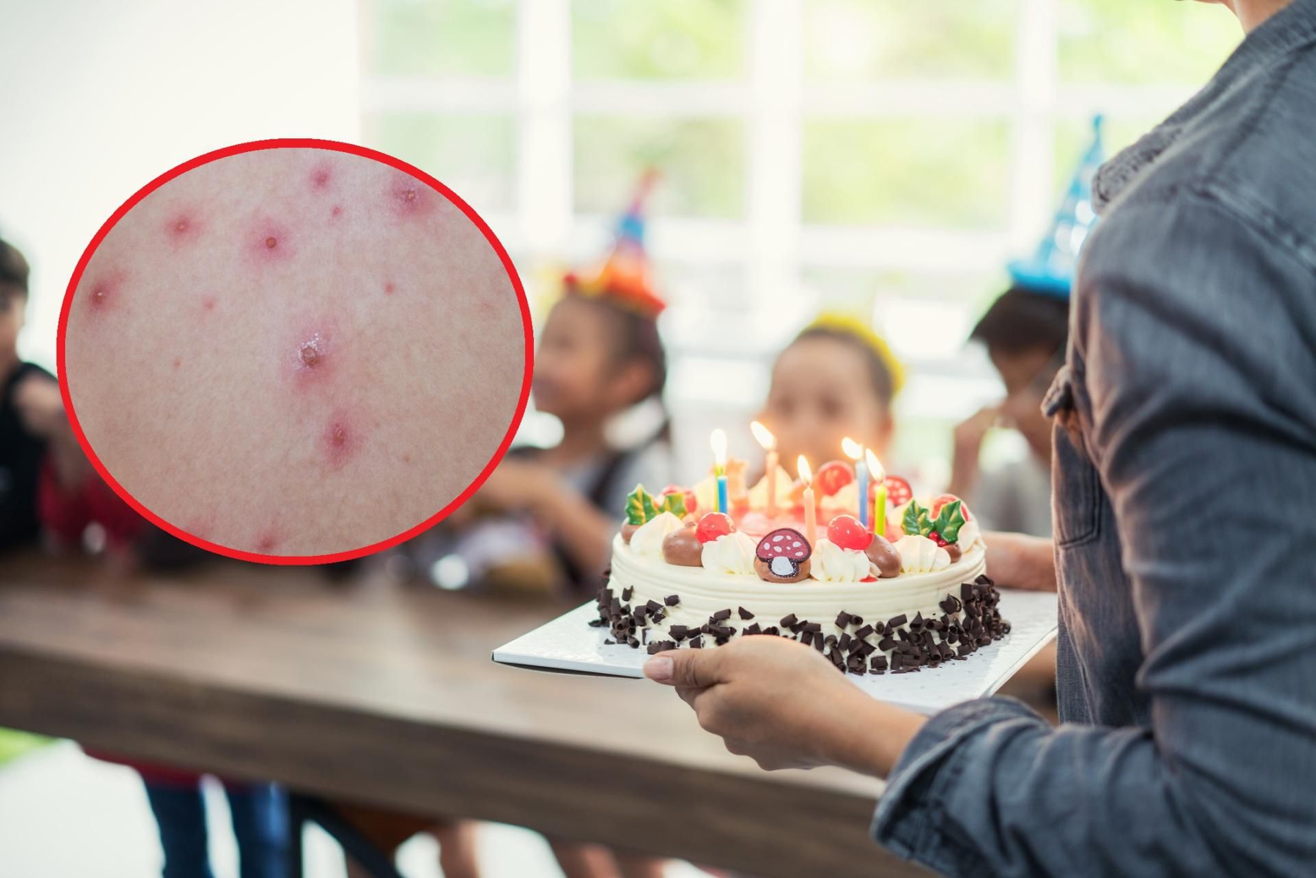 &quot;Ospa party&quot; u znanej na Instagramie mamy