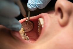 Polacy znaleźli sposób na dentystów. Oszczędzają tak tysiące złotych