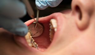 Polacy znaleźli sposób na dentystów. Oszczędzają tak tysiące złotych