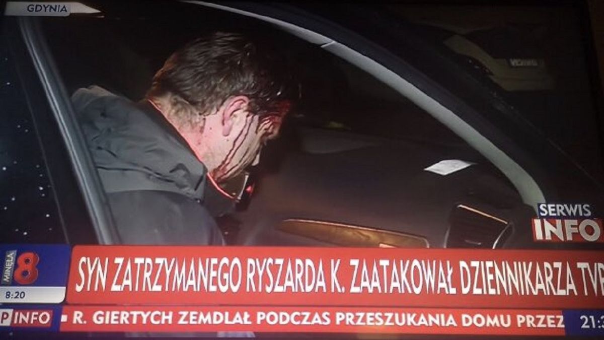 Syn biznesmena zaatakował operatora TVP