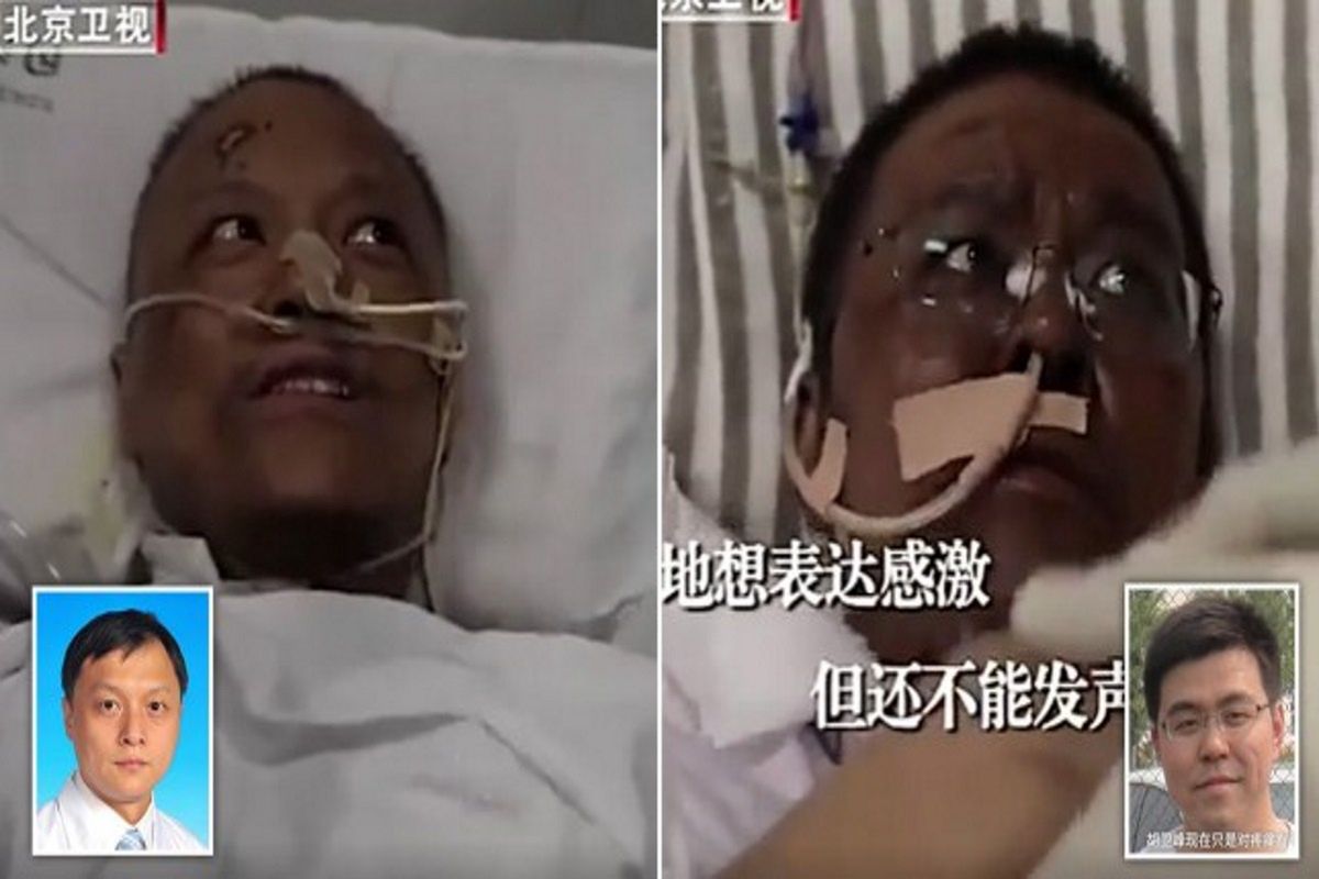 Koronawirus. Skóra chińskich lekarzy zmieniła kolor podczas leczenia COVID-19