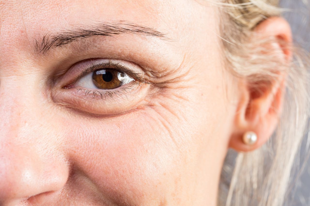 A home remedy for under-eye wrinkles.