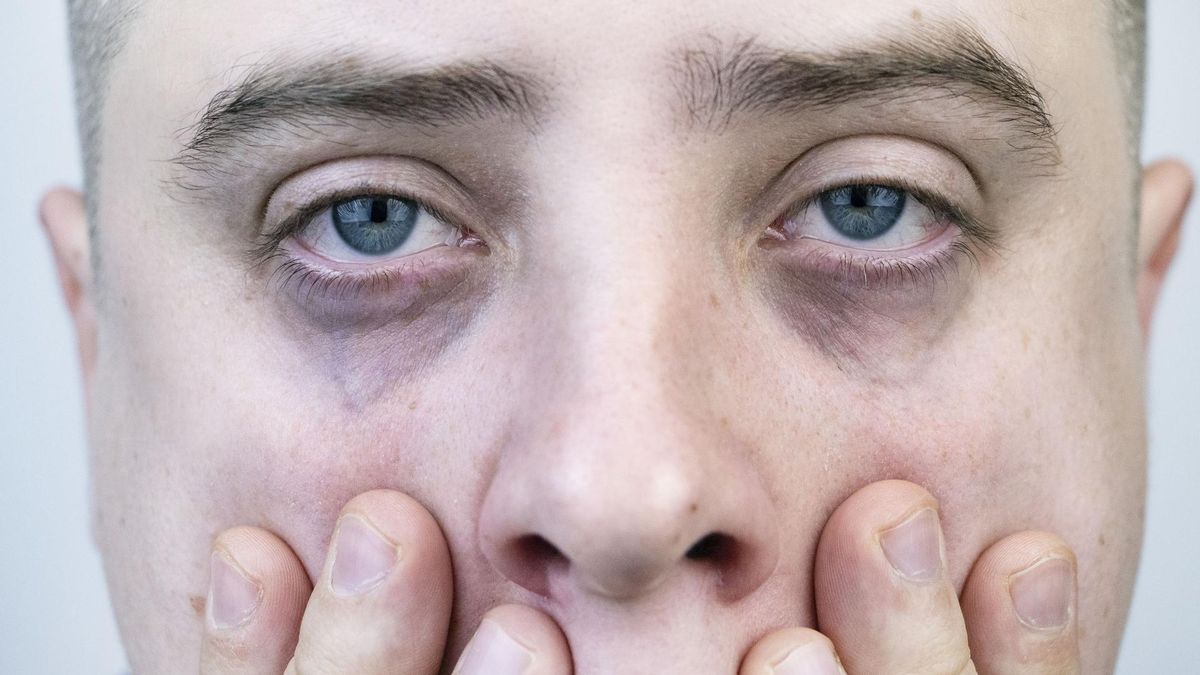 Pierwsze objawy raka mogą pojawić się na twarzy