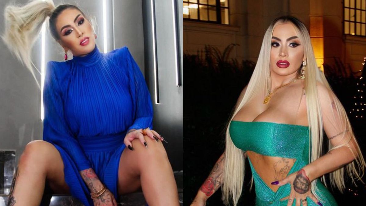 Poddała się zabiegowi BBL. Chce mieć największą pupę na świecie