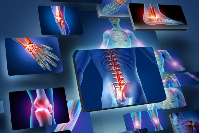 Wśród chronicznych zespołów bólowych najczęściej wymienia się bóle w obrębie jamy brzusznej, bóle w układzie kostno-stawowym, migreny oraz bóle reumatyczne