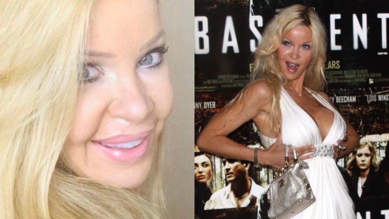 Alicia Douvall poddała się 300 zabiegom upiększającym