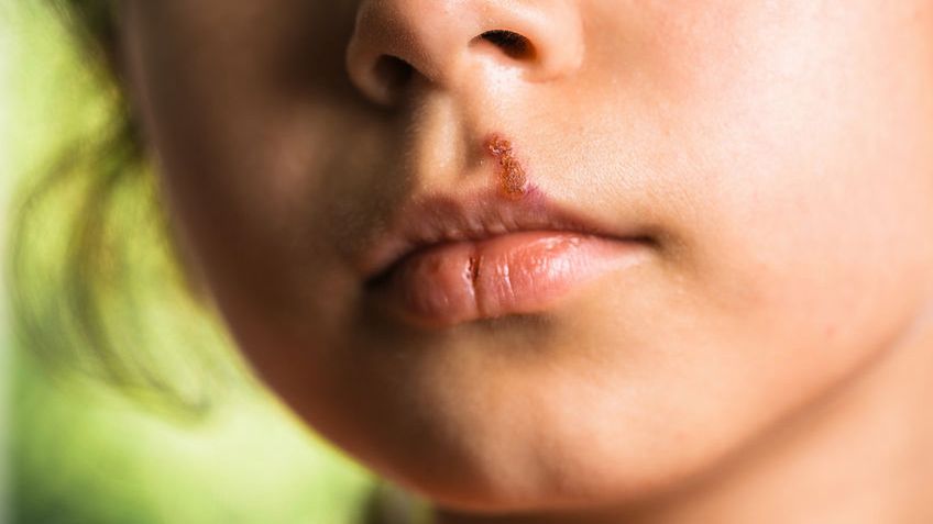 Prototekoza jest rzadką chorobą zakaźną, którą wywołują glony pozbawione chlorofilu