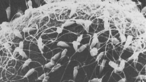 W laboratorium wyhodowano plemniki! 1