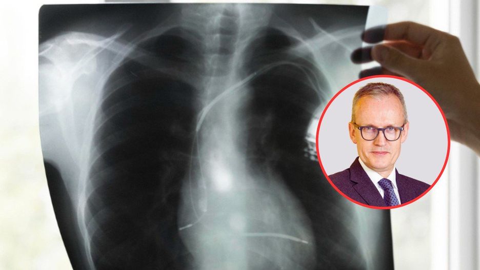 Rak płuca nie czeka. Czas na ogólnopolski standard diagnostyki molekularnej.