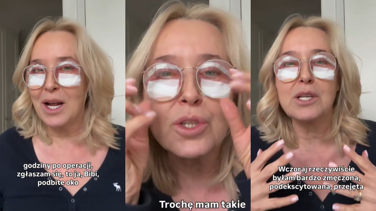 Agata Młynarska przeszła blefaroplastykę
