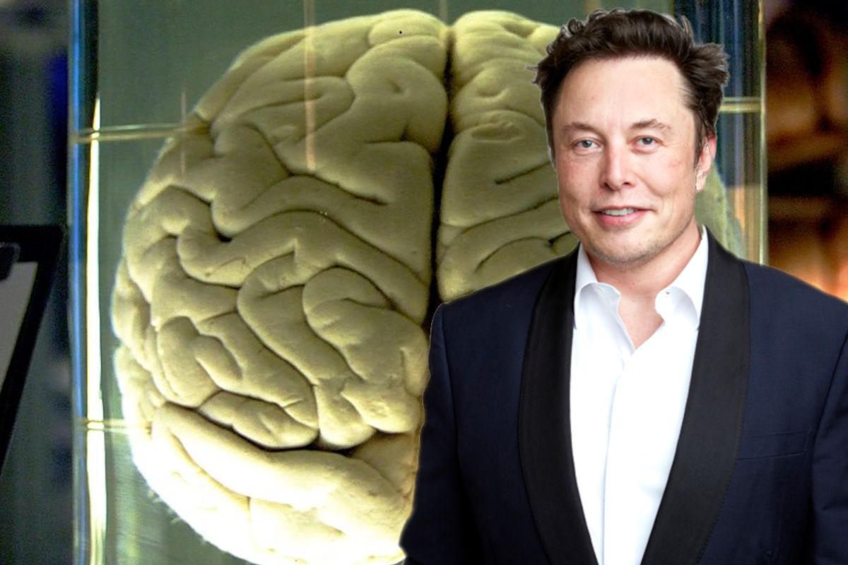 To nie science-fiction. Elon Musk rewolucjonizuje świat implantami mózgu
