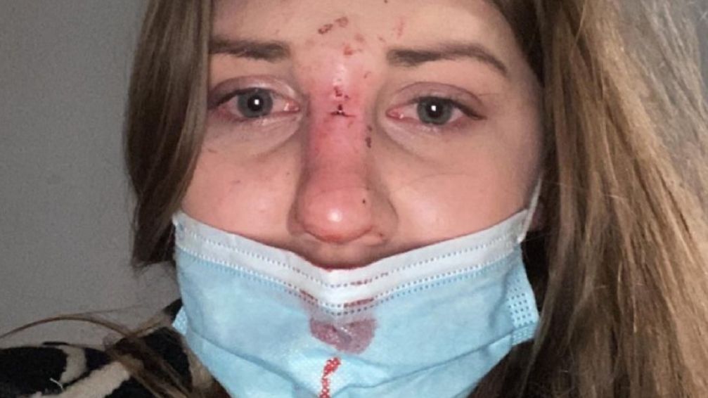 Zdjęcie zaatakowanej kobiety poruszyło internautów