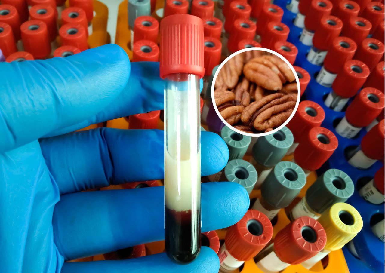 Ich cholesterol spadł. Zdecydowała popularna przekąska?