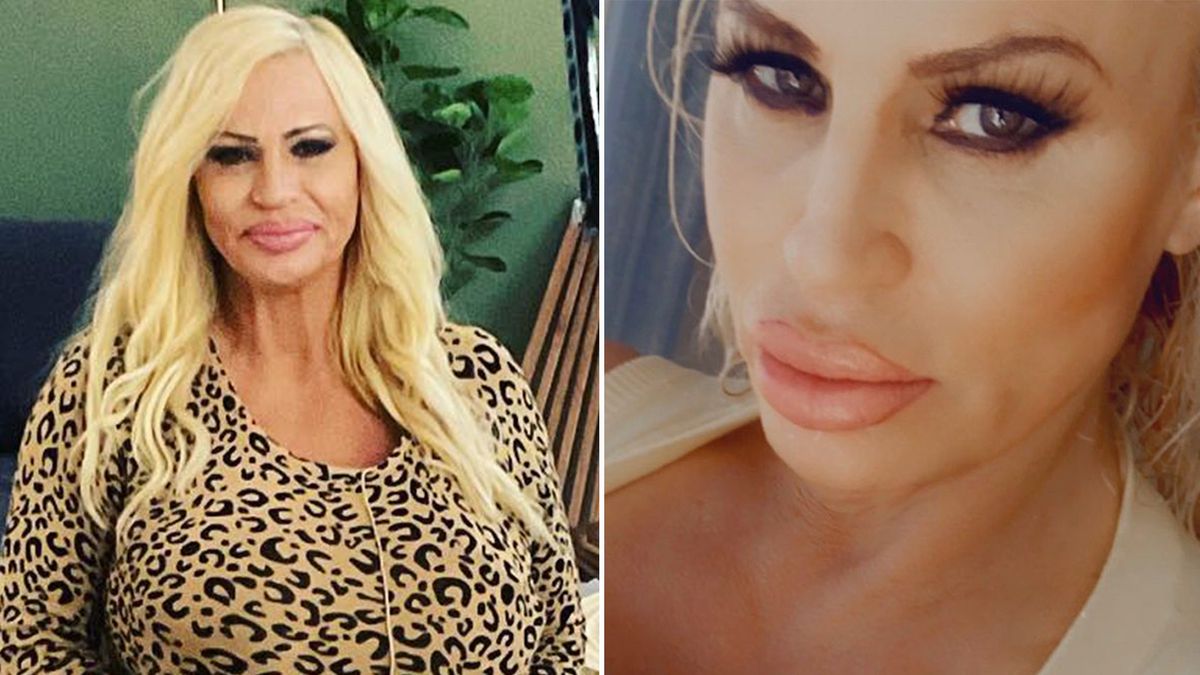 Lacey Wildd przeszła 12 operacji biustu