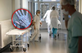 Obudził się z niebieską skórą. Na SOR-ze odkryto przyczynę