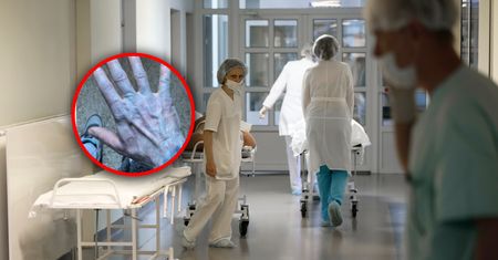 Obudził się z niebieską skórą. Na SOR-ze odkryto przyczynę