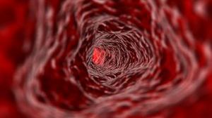 Tak rośnie rak, czyli nowotwór 1