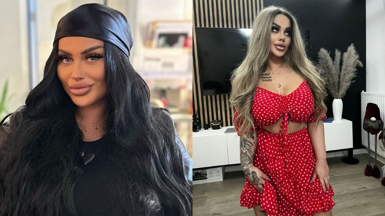 Jak Ewelona wyglądała przed operacjami?