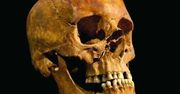 Sensacyjne odkrycie. Czaszka sprzed 5 tysięcy lat nosi ślady operacji