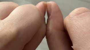 "Test palca". Zajmuje pięć sekund, a może pomóc w diagnozie raka