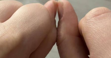 "Test palca". Zajmuje pięć sekund, a może pomóc w diagnozie raka
