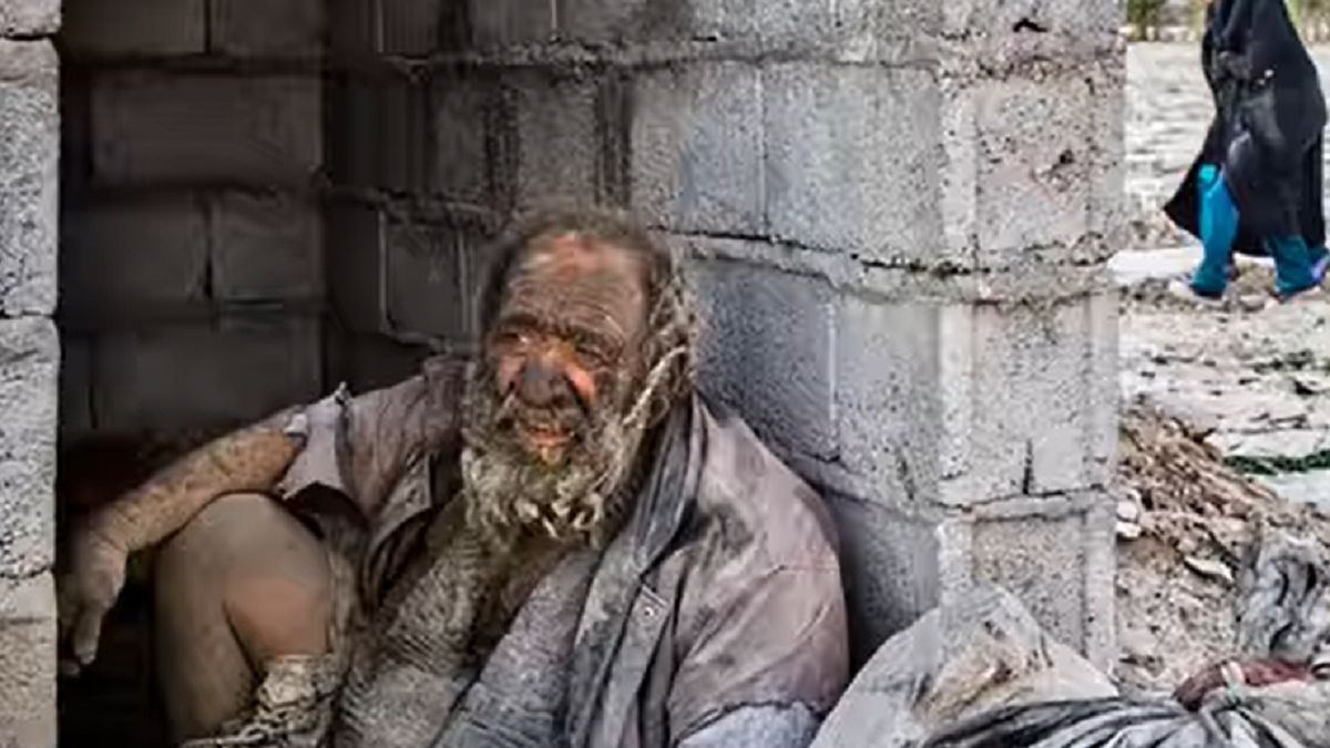 Zmarł "najbrudniejszy człowiek świata".