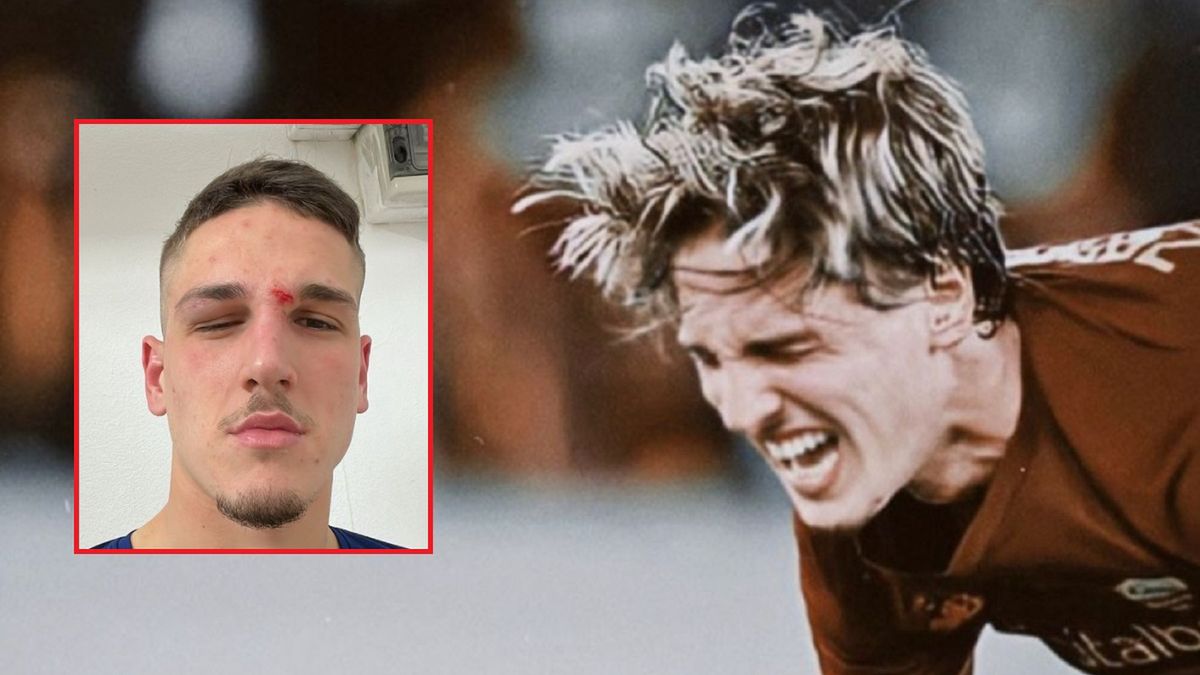 Nicolo Zaniolo ucierpiał w ostatnim meczu