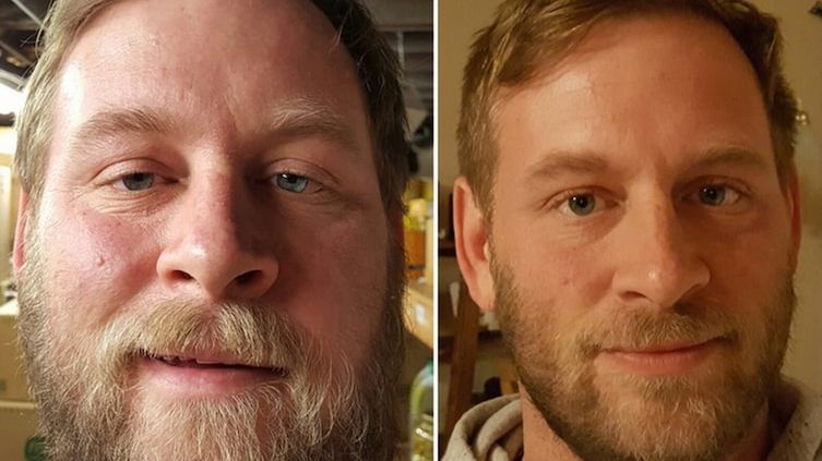 Rezygnacja z alkoholu niesie same pozytywne zmiany